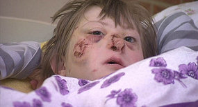 violence against disabled